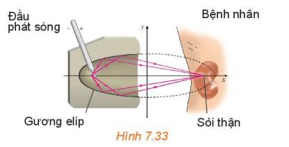 Giải bài 22 Ba đường conic