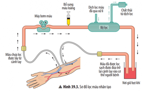 Quan sát Hình 39.3 và mô tả khái quát sơ đồ chạy thận nhân tạo.