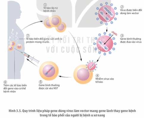 Nêu một số thử nghiệm về liệu pháp gene ở người.