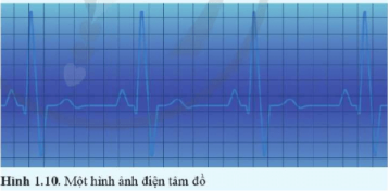 Tim co bóp theo nhịp do được điều khiển bằng một hệ thống các xung điện dẫn truyền trong cơ tim. Máy điện tim ghi nhận những xung điện này và hiển thị dưới dạng đường điện tâm đồ. Đó là những đường gấp khúc, lên xuống biến thiên theo nhịp co bóp của tim.  Dựa vào hình ảnh điện tâm đồ ở Hình 1.10, xác định chu kì đập của tim. Biết rằng mỗi khoảng vuông (theo chiều ngang) tương ứng với khoảng thời gian 0,12 s.