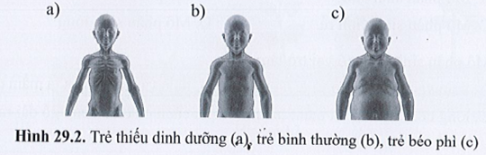 Quan sát hình 29.2 và nêu vai trò của chất dinh dưỡng và chế độ luyện tập đối với con người.