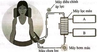 Hình dưới thể hiện nguyên lí hoạt động của máy chạy thận nhân tạo. Dung dịch A hay dung dịch B chứa chất thải? Giải thích.